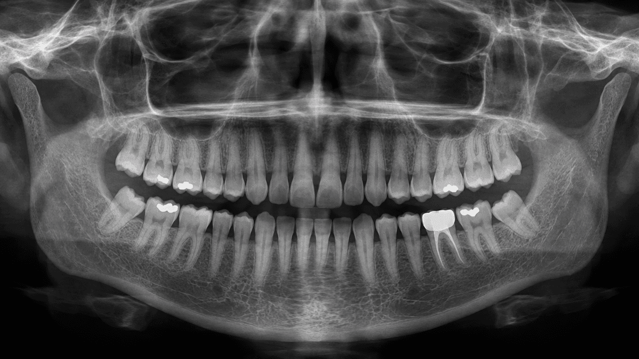Pantomogram pacjentki
